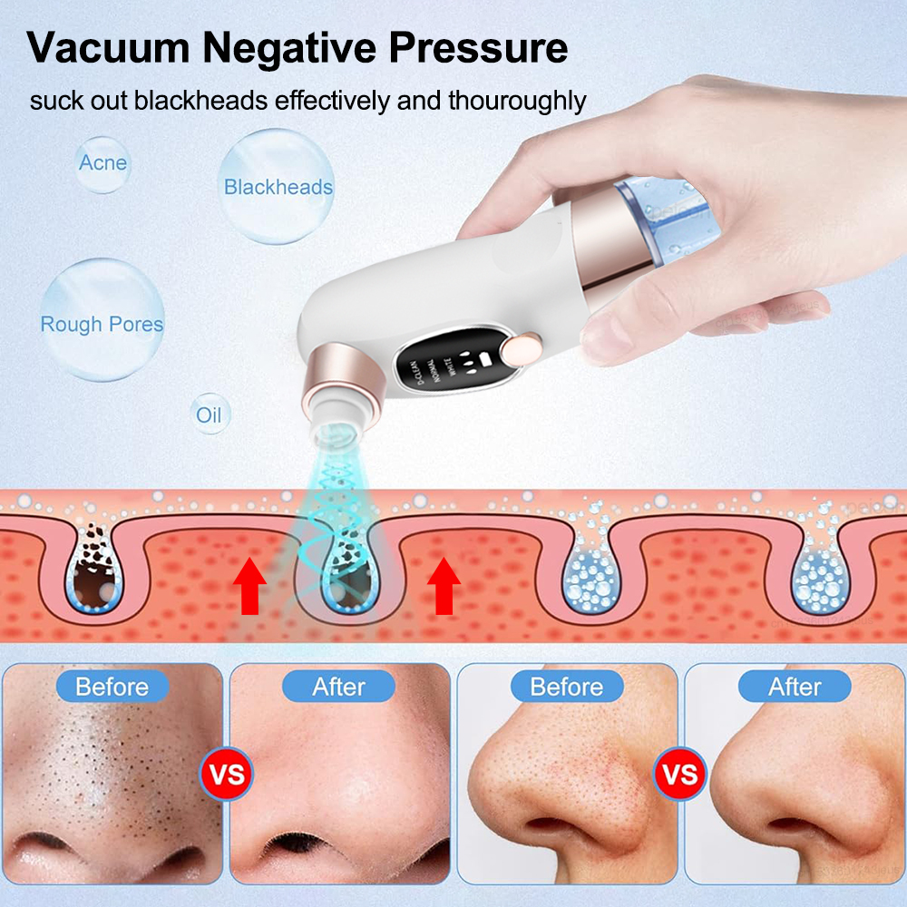 Blackhead Remover Electric Bla - Air Bubble Remover avaliação e preço